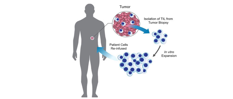 Boosting-the-Efficacy-of-Tumor-Infiltrating-Lymphocytes-via-1@2x